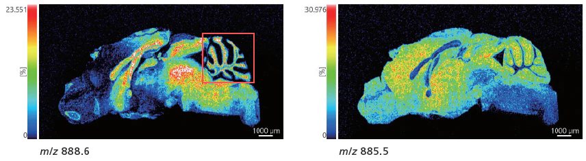 Measurement Results for Whole Brain Spincotech