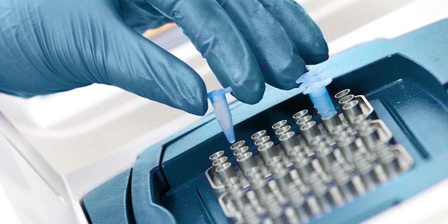 Cystic Fibrosis Spincotech Yourgene
